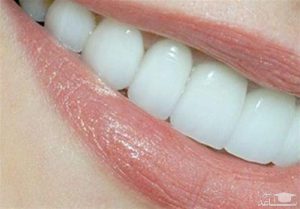 3cvy45yv46y64 300x209 دلایل مهم شکستن دندان چیست؟